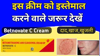 Betnovate c skin cream review  Betnovate c lagane se kya hota hai [upl. by Bibi]