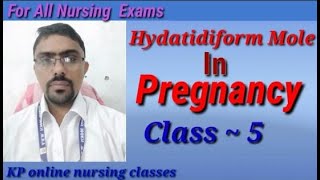 Hydatidiform mole in pregnancy class05 [upl. by Leffen787]