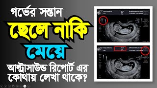 আল্ট্রাসনোগ্রাম রিপোর্ট দেখে কিভাবে বুঝবেন গর্ভের বাচ্চা ছেলে না মেয়ে  pregnancy ultrasound report [upl. by Ahseer]