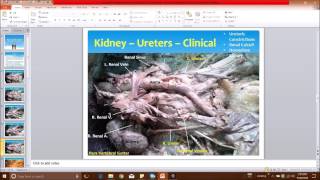 Aorta–IVC–Kidney Dissection and Surgical Correlations  Dr Sanjoy Sanyal [upl. by Fred11]