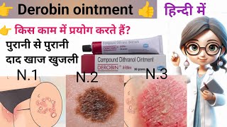 Deribin ointment use in hindi  डेरोबिन ointment use in hindi 30g l use।ointment lviralviralvideo [upl. by Latsyrhk]