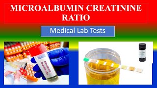 MICROALBUMIN CREATININE RATIO TEST  Lab Tests  What is   Uses  Need  Preparation  Results [upl. by Ecirp]