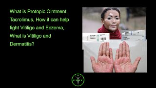 What is Protopic Ointment Tacrolimus How it can help fight Vitiligo and Eczema What is Vitilig [upl. by Festus516]