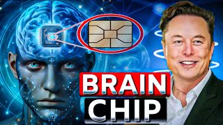 Neuralink Brain Chip  Neuralink Chip Explained in Hindi [upl. by Assehc141]