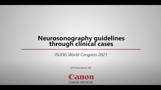 ISUOG 2021 Miguel Branco – Neurosonography guidelines through clinical cases [upl. by Ignacio]