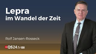 Lepra Die älteste Infektionskrankheit und ihre heutige Relevanz  Unter der Lupe  QS24 [upl. by Aynatahs848]