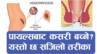 Piles  Hemorrhoids पायल्सबाट कसरी बच्ने  सजिलो तरिका हेर्नुहोस Nepali Health Tips [upl. by Eibrab]