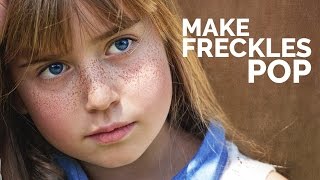 How to Enhance Freckles and Make them Pop in Photoshop AskPiX [upl. by Ydnamron61]