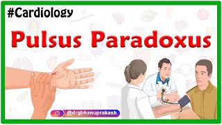 Pulsus Paradoxus  Examination of the arterial pulse  Cardiology USMLE [upl. by Adnyleb187]