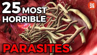 25 Parasites You Do Not Want To Be Infected With [upl. by Dikmen]