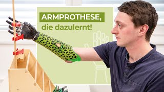 Wie wird eine myoelektrische Armprothese gesteuert Myo Plus Steuerung [upl. by Adrahs328]