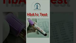 HbA1c Test  Hematology laboratory shortsvideo [upl. by Amoreta643]