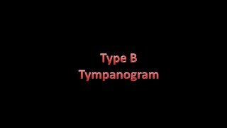 type B tympanogram [upl. by Enelam]