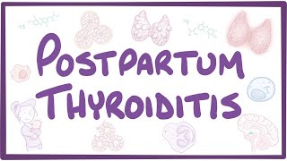 Postpartum thyroiditis  causes symptoms diagnosis treatment pathology [upl. by Natie772]