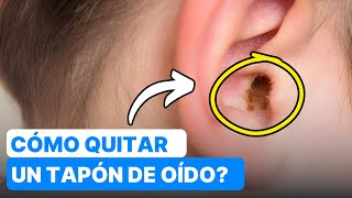 ¿Cómo Quitar un Tapón de Cera aceite de oliva velas 😮 [upl. by Aicirtal927]