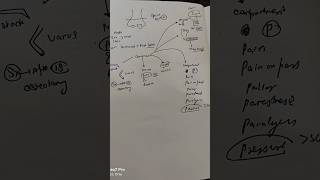 Supracondylar fracture neetpreparation orthopedics [upl. by Christos]