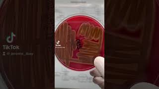 Beta hemolytic pattern of Staphylococcus aureus shorts fyp medtech [upl. by Maroney398]