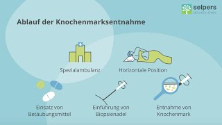 Knochenmarksbiopsie beim MantelzellLymphom  Untersuchung des Knochenmarks Experte erklärt [upl. by Sonitnatsok]