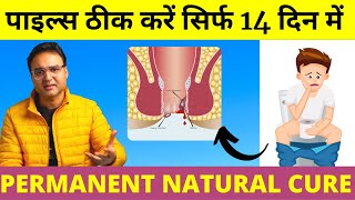 Piles Treatment पुराने से पुराना पाइल्स बवासीर 14 दिन में जड़ से ठीक करें  Piles Home Treatment [upl. by Crofoot238]