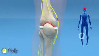 COOLIEF Genicular nerve block and radiofrequency of the Knee Joint [upl. by Ferrigno]