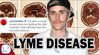 Lyme Disease Is On The Rise And Its Bad [upl. by Atik]