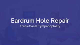 Eardrum Holes with Our CuttingEdge TransCanal Tympanoplasty Procedure [upl. by Barimah]