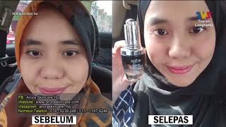 Arora Skincare Di Malaysia Hari Ini MHI [upl. by Derry]