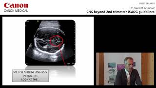 Dr Laurent Guibaud  CNS Beyond 2nd Trimester ISUOG Guidelines [upl. by Nehtanoj173]