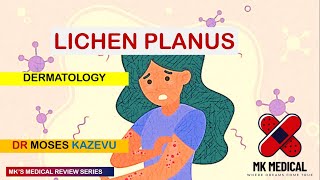 Lichen Planus Dermatology [upl. by Gelya]