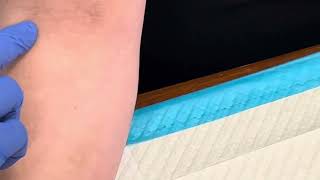 3 Tips For Locating DIFFICULT Veins  Phlebotomy Tip  Medical Assistant Training [upl. by Melba]