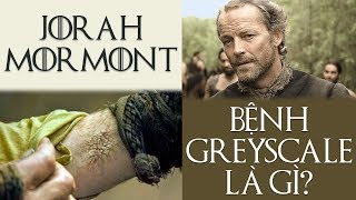 Game of Thrones  JORAH MORMONT MẮC BỆNH GÌ VÀ CÓ CHỮA ĐƯỢC KHÔNG [upl. by Darline]