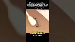 How to Remove Stitches Sutures Nursing Clinical Skill shorts nursing nurse [upl. by Nagek]