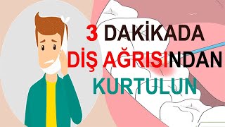 Diş Ağrısına Ne İyi Gelir  Diş Ağrısına Kesin Çözüm [upl. by Lakim]