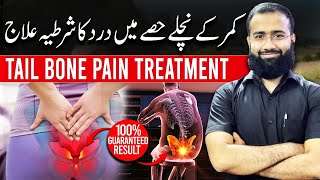 Tailbone Pain Treatment  Coccyx Pain Relief Exercises [upl. by Natasha]