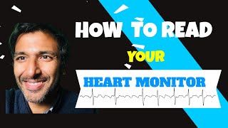 How to read your heart monitor trace [upl. by Ideih283]