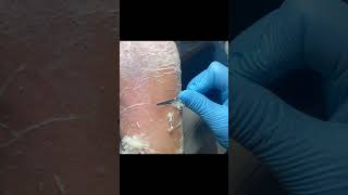 Charming pedicure video  Remove dead skin [upl. by Anytsirk]