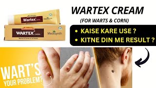 WARTEX CREAM  MASSE KE LIYE CREAM  MASSE HATANE KE LIYE CREAM  WARTS REMOVER  CORN REMOVER CREAM [upl. by Cung]