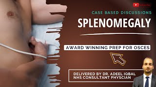 Splenomegaly  Abdominal  BEST OSCE Preparation for Medical Student Exams [upl. by Aluin]