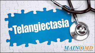 Telangiectasia ¦ Treatment and Symptoms [upl. by Eimarrej]