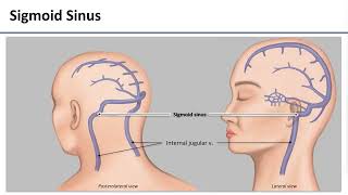 LO6 Dural Venous Sinuses [upl. by Htrahddis]