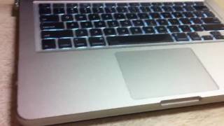 How To Remove Incase  Speck Hardshell Case OFF your Macbook [upl. by Ehtylb]