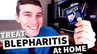 What is Blepharitis How to Treat Blepharitis at Home [upl. by Nerrot]