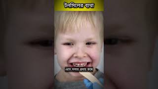 Tonsil Pain Relief Simple and Effective Home Remedies [upl. by Yednarb]