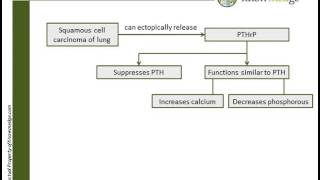 Internal Medicine ABIM Board Exam Review Question PTHrP [upl. by Ylicic]