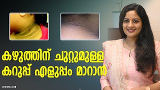 കഴുത്തിന് ചുറ്റുമുള്ള കറുപ്പ് എളുപ്പം മാറാൻ  HOW TO GET RID OF DARK NECK FAST amp NATURALLY [upl. by Amehr]