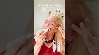 Microneedling amp Hexapeptide8 Your AntiAging Duo antiagingtreatment antiagingskincare aging [upl. by Nohsav]