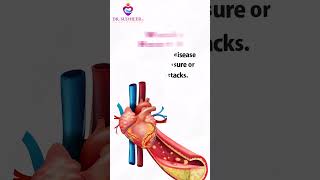 Congestive Heart Failure Causes Symptoms and Treatment Options  Dr Sudheer Koganti shorts [upl. by Seravart954]