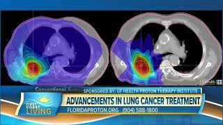 Lung Cancer Treatment Advancements [upl. by Kauffmann]