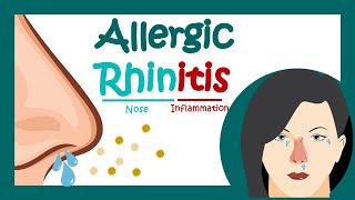 Allergic rhinitis  What is Allergic Rhinitis  What is the main cause of allergic rhinitis [upl. by Edveh283]