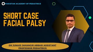 Short Case Facial Palsy [upl. by Oremodlab]